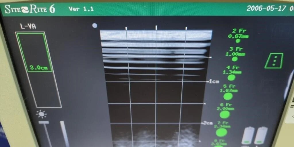 Bard Site Rite 6 Ultrasound System with Probes & Cart — Ultrasound Machines — view 11