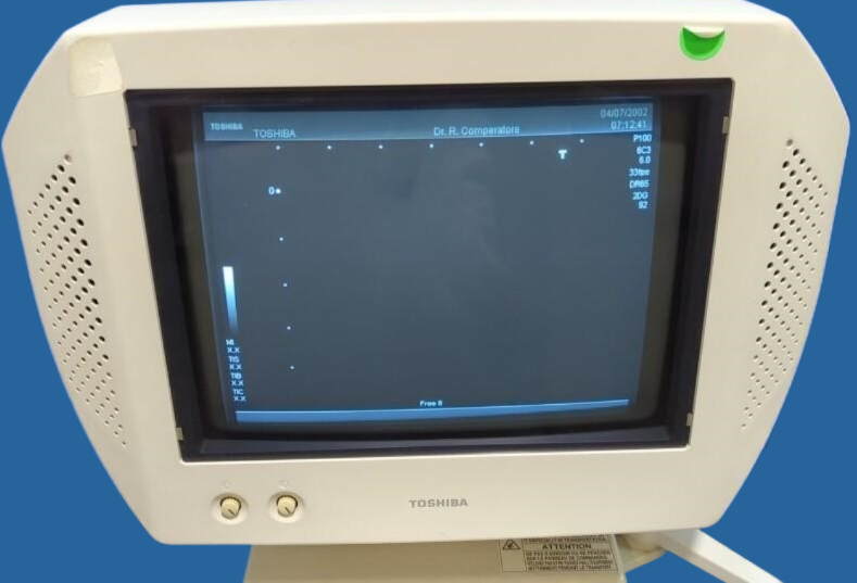 Toshiba Nemio 10 Diagnostic Ultrasound System — Ultrasound Machines — view 10
