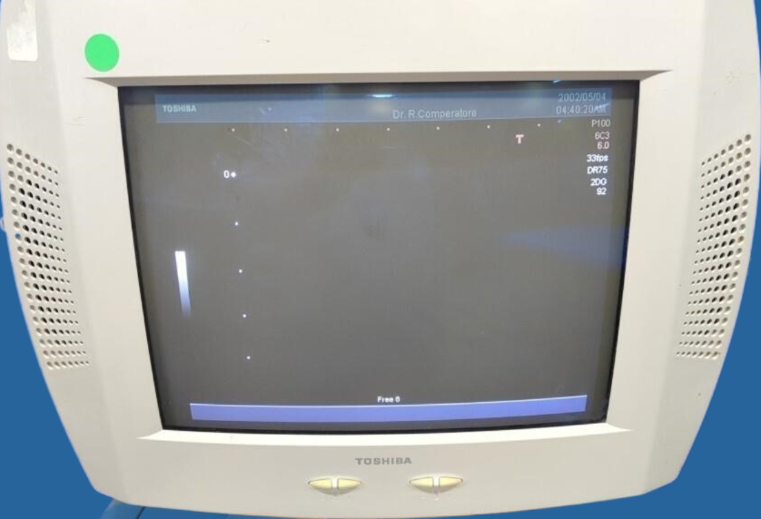 Toshiba Nemio 20 Diagnostic Ultrasound System — Ultrasound Machines — view 18