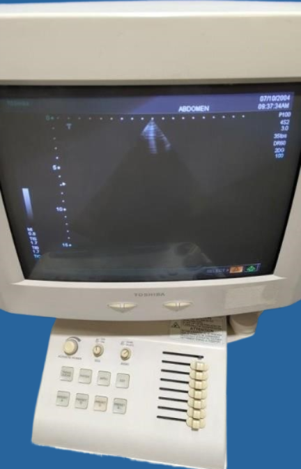 Toshiba Nemio 30 Diagnostic Ultrasound System — Ultrasound Machines — view 3