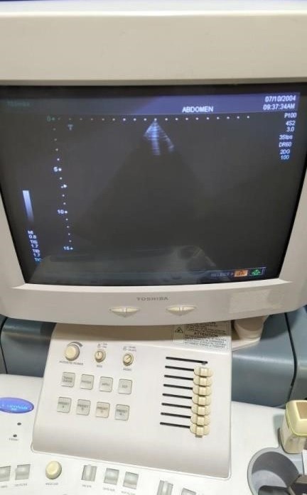 Toshiba Nemio 30 Diagnostic Ultrasound System — Ultrasound Machines — view 4