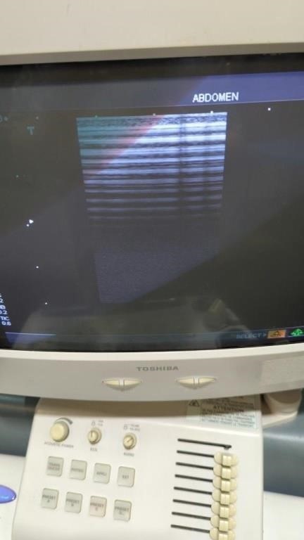Toshiba Nemio 30 Diagnostic Ultrasound System — Ultrasound Machines — view 5