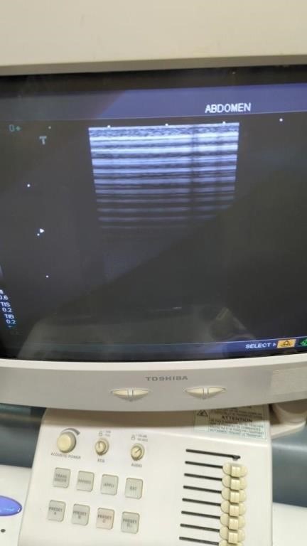Toshiba Nemio 30 Diagnostic Ultrasound System — Ultrasound Machines — view 6