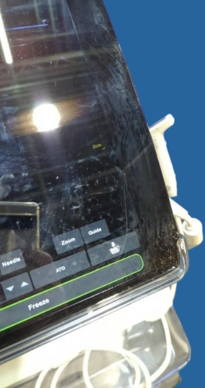 GE Venue 50 Portable Ultrasound System with L8-18I-SC Probe — Ultrasound Machines — view 15