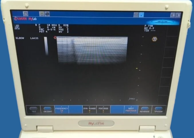 ESAOTE MyLabFive Ultrasound System with Probe & Foot Pedals — Ultrasound Machines — view 10